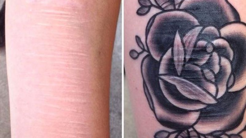 Tattoo Artist Spends Free Time Covering Scars Of DV & Self-Harm Survivors