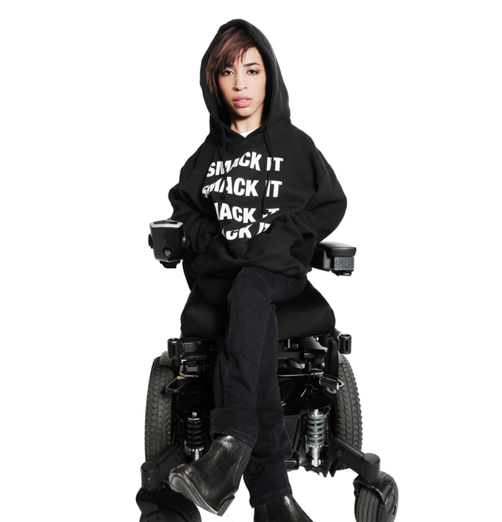 Beyoncé Casts IMG Model With Muscular Dystrophy For Babin’ Merch Campaign
