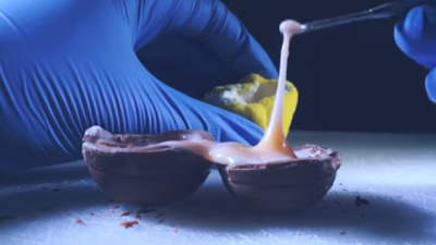 WATCH: ‘Food Surgeon’ Gives Goosebumps With Gooey Easter Egg Transplant