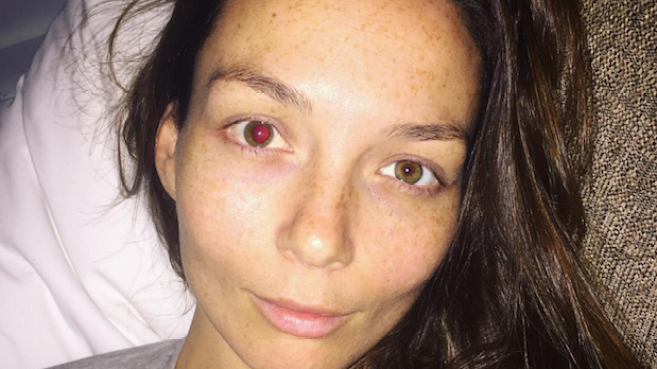 Ricki-Lee Copped A Champagne Cork To The Eye, Posts Brutal ‘Gram As Proof