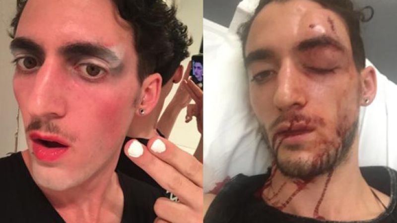 Protest To Keep Newtown ‘Weird & Safe’ Organised After Queer Man Bashed