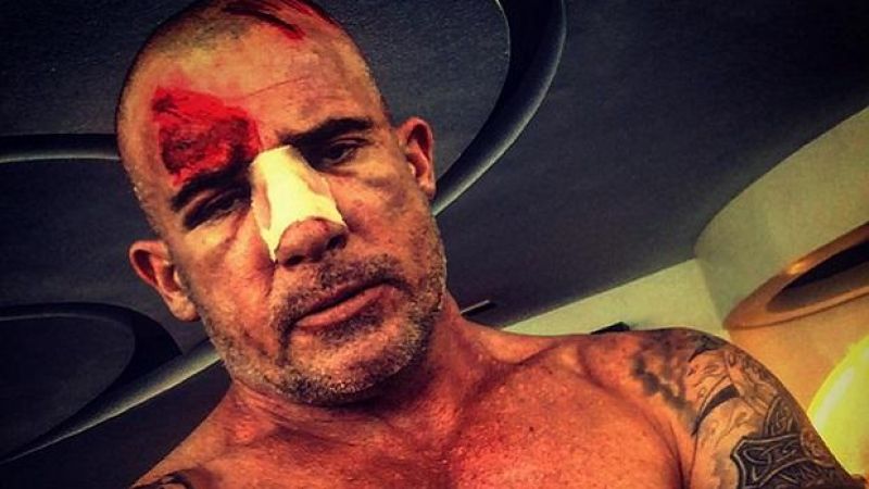 Aussie Prison Break Star Dominic Purcell Cops On-Set Injury From Iron Bar
