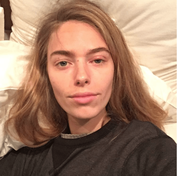 Aussie Model Calls Out Industry After Makeup Brushes Give Her Golden Staph