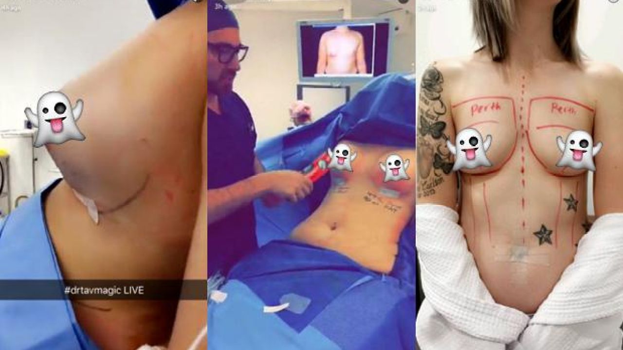 There’s An Aussie Plastic Surgeon Snapchatting Boob Jobs