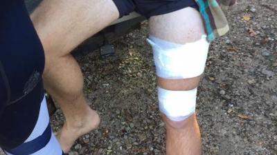 Surfer Lucky To Be Alive After Third Shark Attack Near Byron Bay In A Month