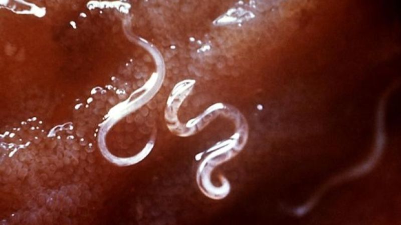 QLD Researchers Trial A Gut Full Of Hookworms As Cure For Coeliac Disease