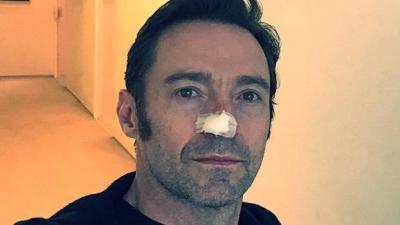 Hugh Jackman Has 4th Skin Cancer Removed, Urges You To Use Bloody Sunscreen