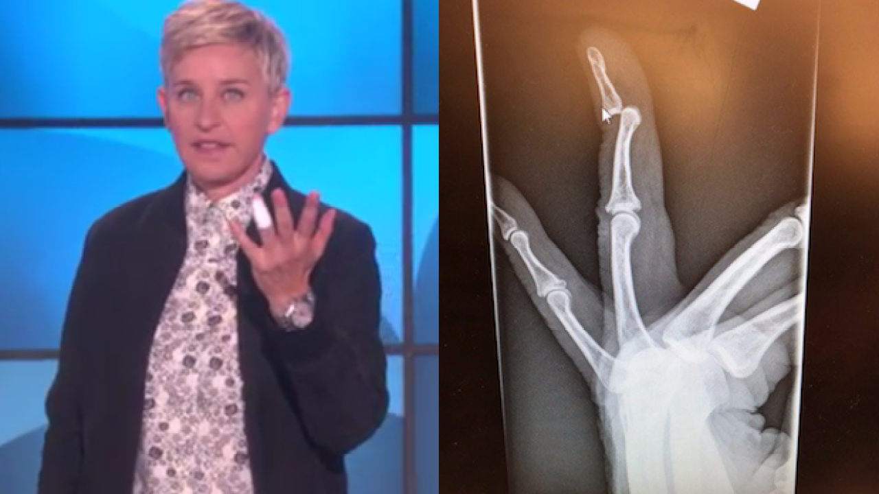 WATCH: Ellen Borked Her Finger In A Post-Wine Tumble & Extremely Same, TBH