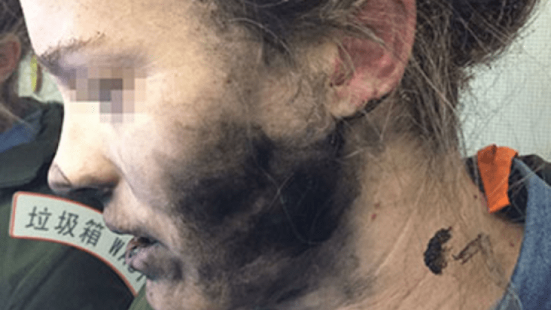 Travellers Cop New Battery Warning After Headphones Explode On Melbs Flight