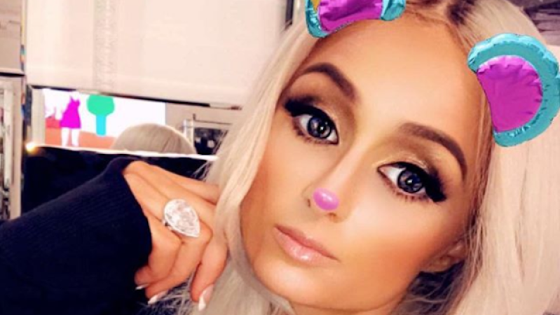 The Latest Plastic Surgery Trend Is Looking Like A Snapchat Filter