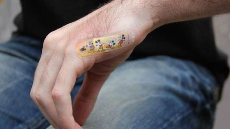 NSW Government Cancels The Opal Card A Man Had Implanted Into His Hand