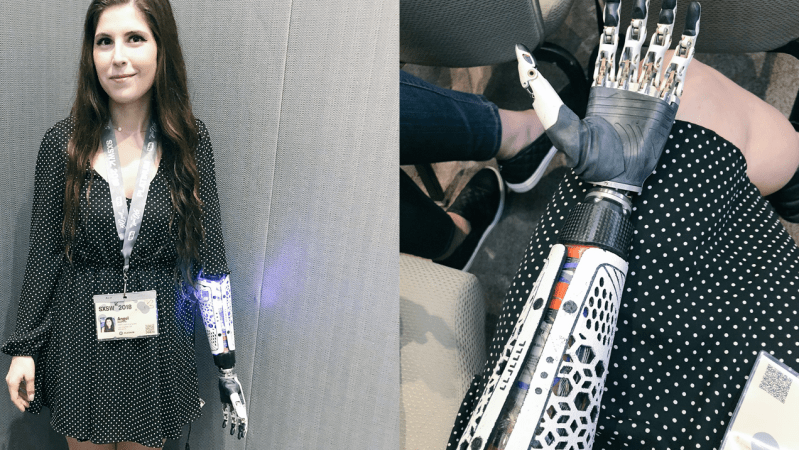Woman With Bionic Prosthetic Was Refused Space To Charge Arm At Tech Panel