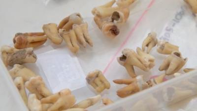 Melbourne Metro Tunnel Dig Finds A Thousand Human Teeth Just Lying There