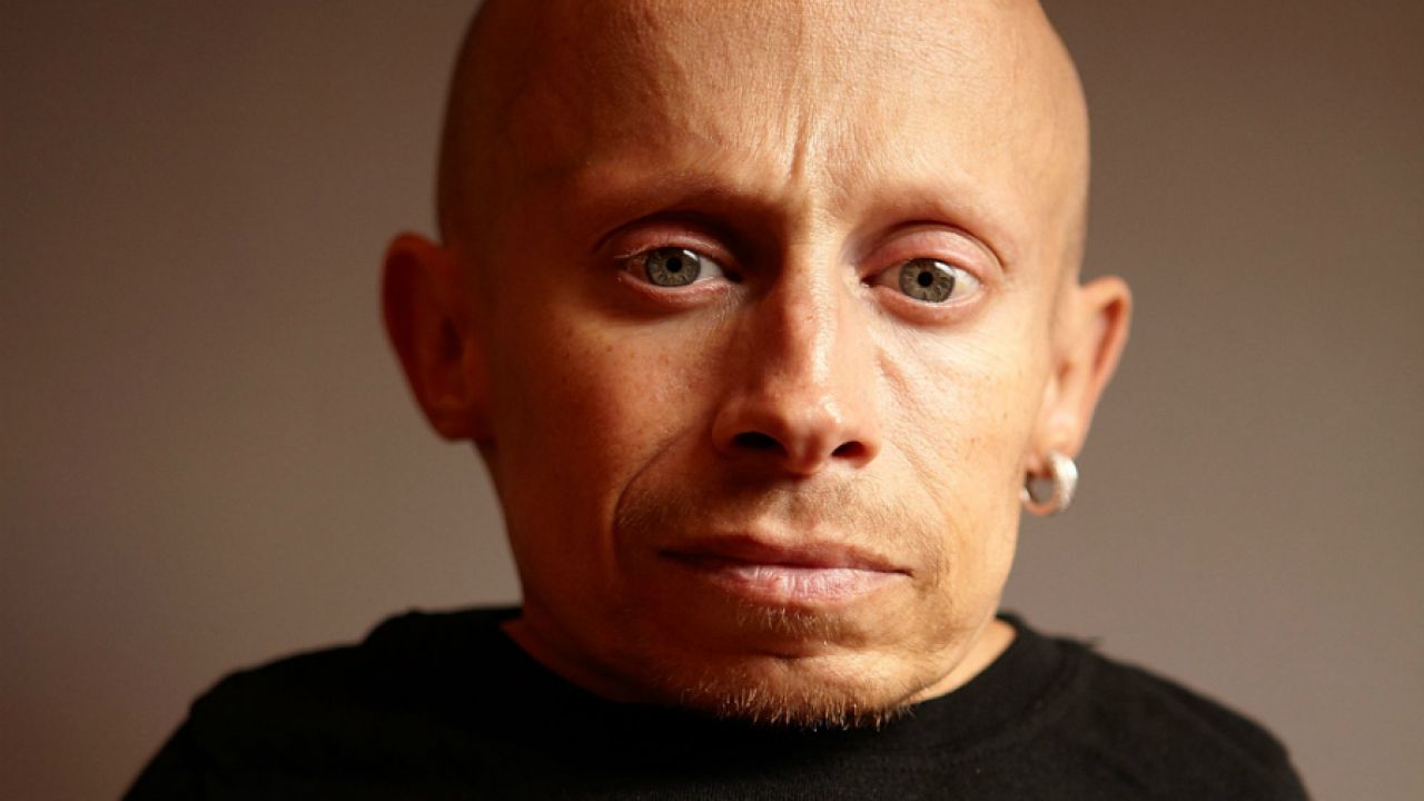 Verne Troyer’s Death This Year Ruled A Suicide, Coroner’s Report Concludes