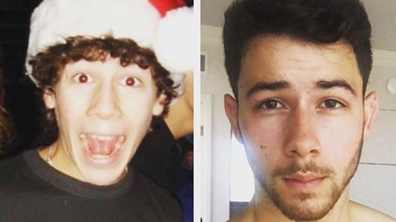Nick Jonas Marks 13 Years Since Being Diagnosed With Type 1 Diabetes 