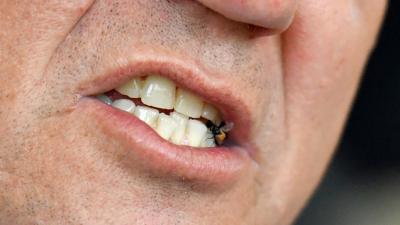 The Fly Inside Scott Morrison’s Mouth Is Proof Technology Has Gone Too Far