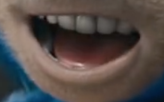 Why Does Sonic The Hedgehog Have Horrifying Human Teeth?
