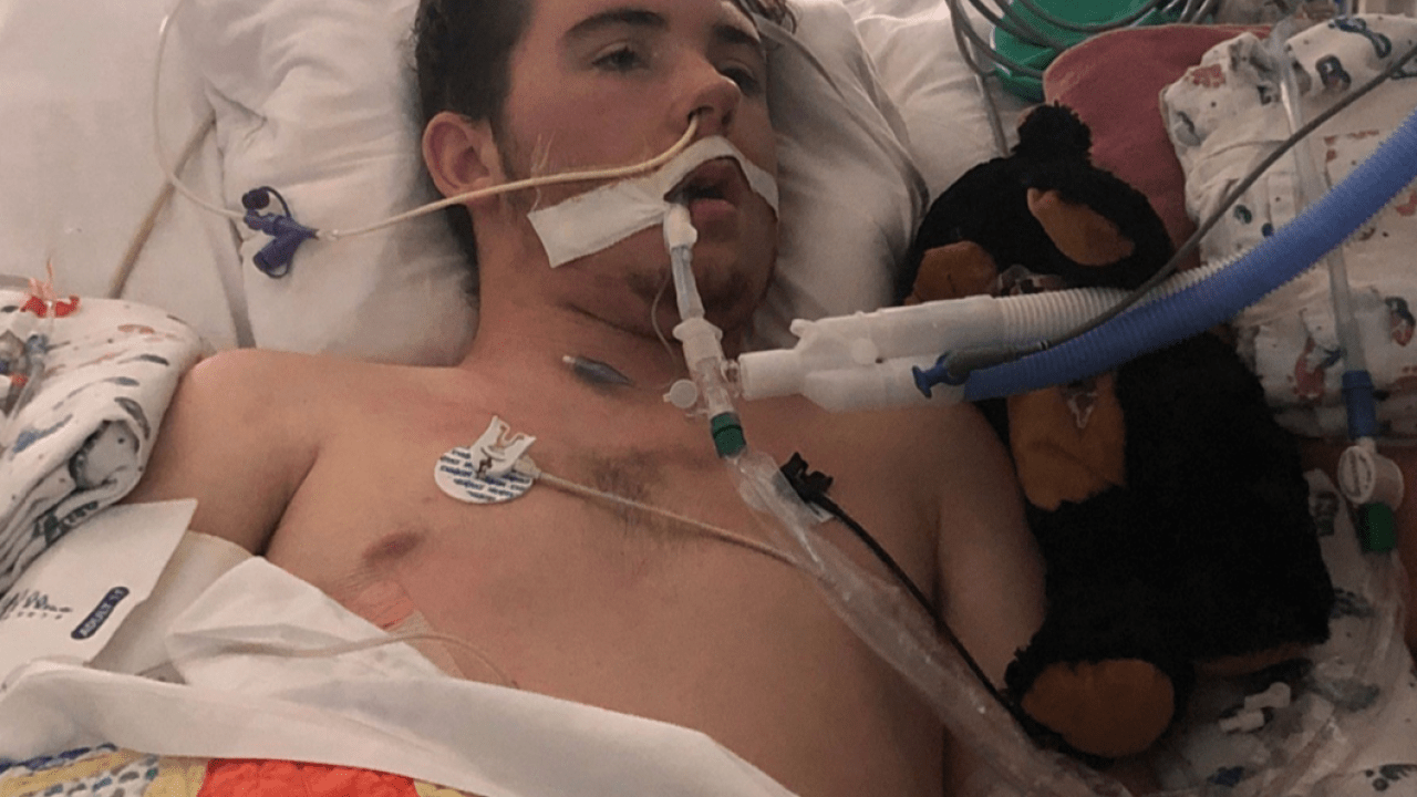 You Might Wanna Put The Vape Down ‘Coz This 17 Y.O’s Doctors Say It Completely Blocked His Lungs