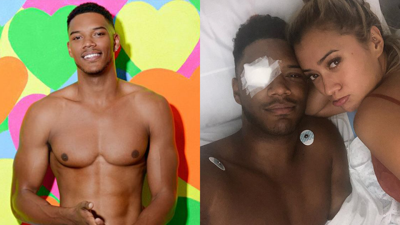 ‘Love Island’ Alumni Theo Campbell Blinded In One Eye After Champagne Cork Incident