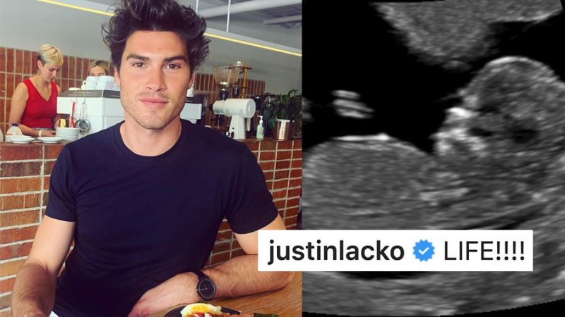 ‘Love Island’ Daddy Justin Lacko Is About To Become A Literal Daddy