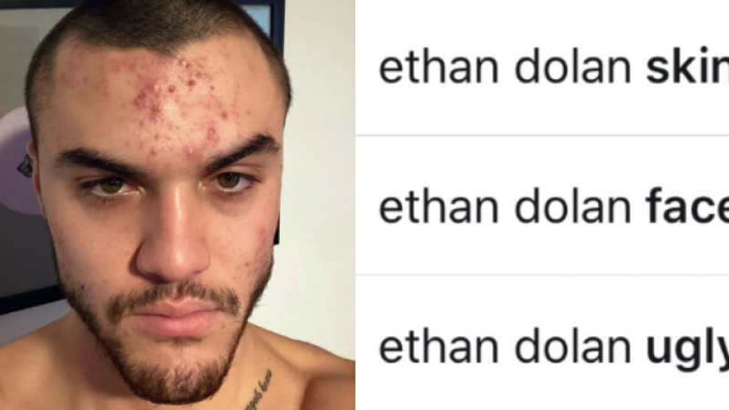 YouTuber Ethan Dolan Slams “Shitty” Comments From Fans About His Skin