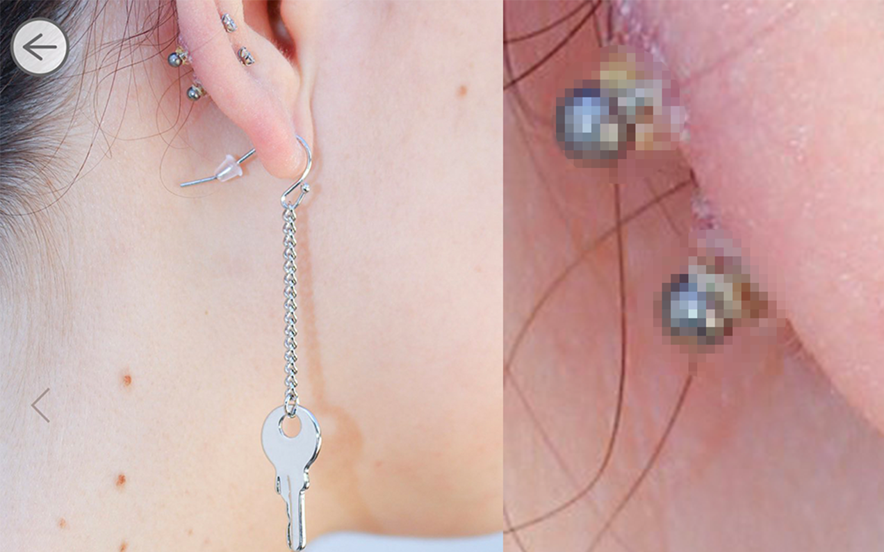 How To Tell If Your Piercing Is Infected
