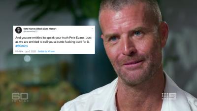 Pete Evans Roasted For ‘60 Mins’ Interview & I Hope The BioCharger Has A Cure For That Burn