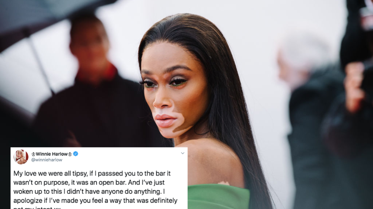 Model Winnie Harlow Apologises After Claims Of “Bulldozing” Woman At Open Bar Event