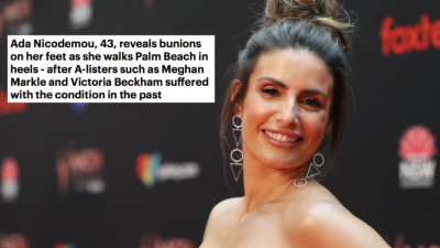 This Garbage Fire Of An Article About Ada Nicodemou’s Bunions Has Absolutely Done Me In