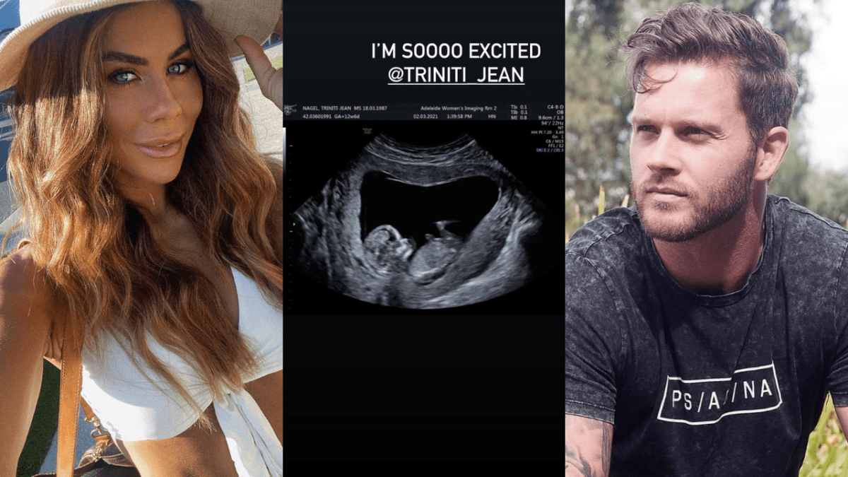 Sophie Guidolin, Jake Edwards and Sophie's ultrasound post
