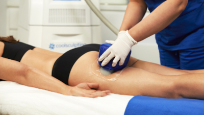 I Tried CoolSculpting, That Scary-Sounding Fat-Freezing Treatment, To See If It’s Worth The $$