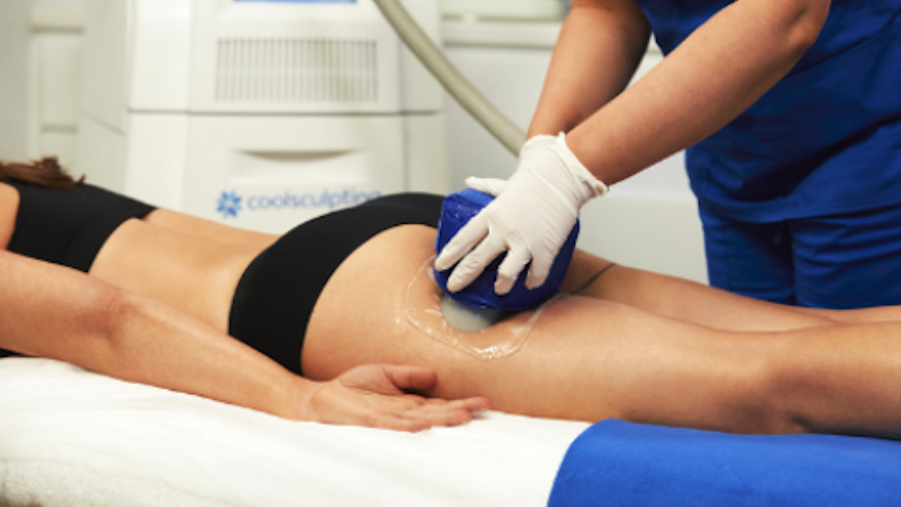 I Tried CoolSculpting, That Scary-Sounding Fat-Freezing Treatment, To See If It’s Worth The $$
