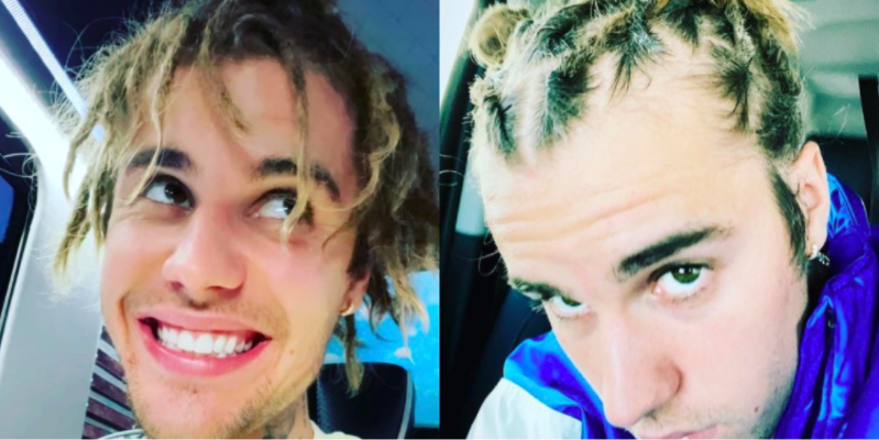 Justin Bieber Shaves His Head & Gets Rid Of Dreads — Before & After –  Hollywood Life