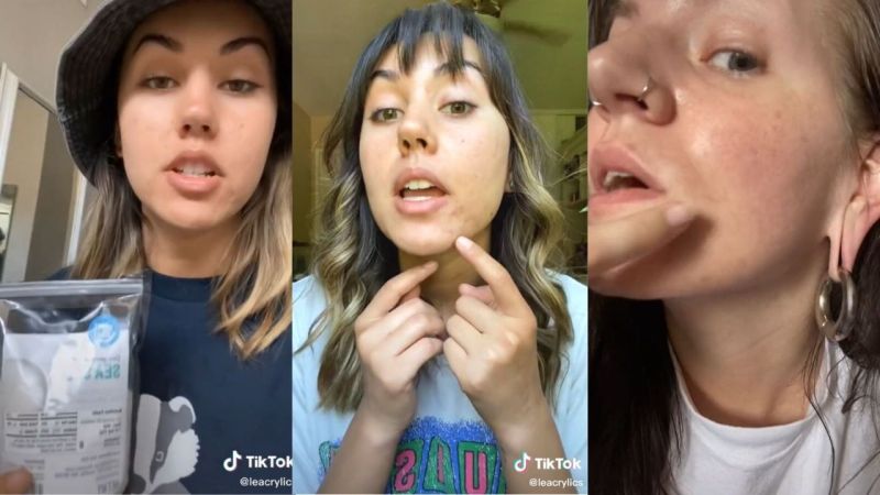 TikTok Claims That Salt Water Can Cure All Acne Issues And The Reviews Are Glowing (Literally)