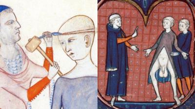 How Did Blokes 1000 Years Ago Handle Limp Dicks & Balding? An Investigation
