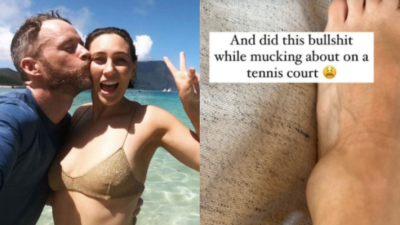 Ya Girl Zoë Foster Blake Suffered A Nasty Injury While On Vacay & The Insta Stories Are Brutal
