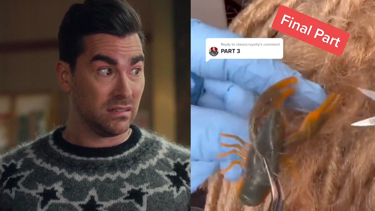 A Bloke Found A ‘Lobster’ In His Dreadlocks And The Three-Part Saga Is Extremely Vom-Worthy