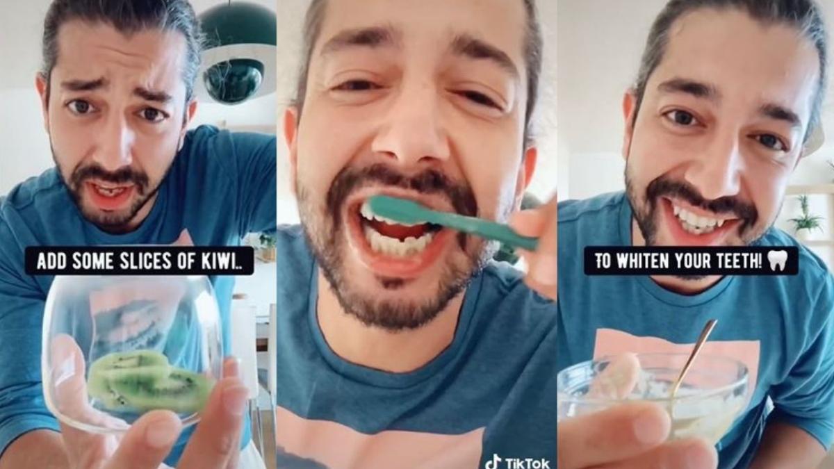 kiwi teeth hack dentist whitening hack