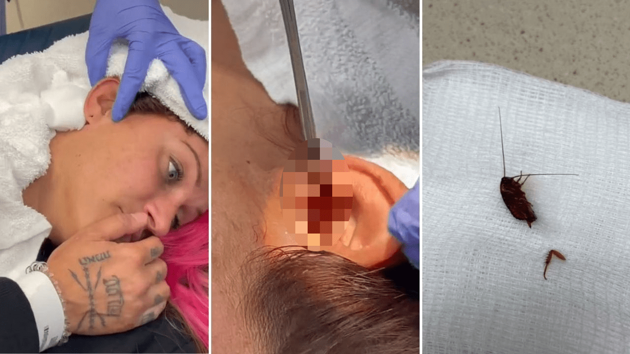 In Today’s Nightmare Fuel, This Woman Had A Whole Cockroach Pulled Out Of Her Ear