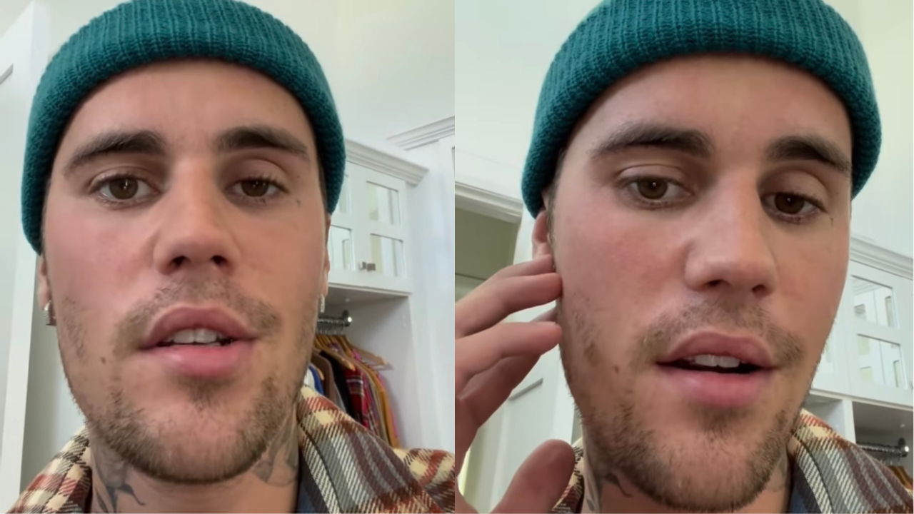 In An Emotional Vid, Justin Bieber Reveals He Has A Virus Causing Paralysis In Half His Face