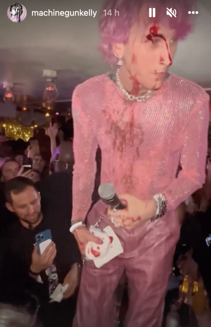 MGK Smashed A Glass Over His Head During A Performance & Shared The Disturbing Footage On IG