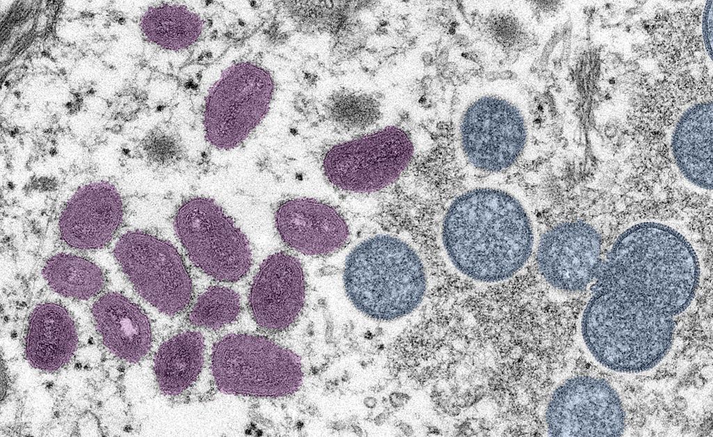 Microscopic image of monkeypox virus