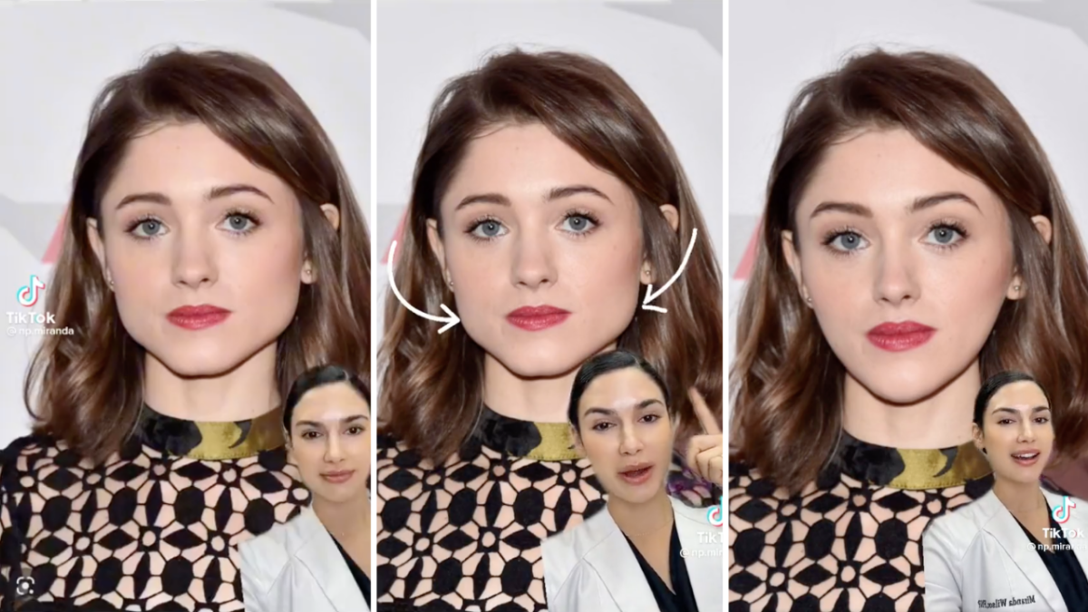 Screenshots of actress Natalia Dyer in a TikTok from an aesthetic nurse practitioner