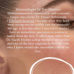 Khloe kardashian skin cancer melanoma