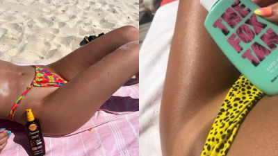Fuck The Return Of Sunbaking, Skin Cancer Is Not A Trend