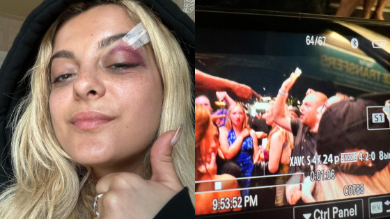 The Guy Who Allegedly Threw His Phone At Bebe Rexha Explained Why He Did It & This Is Fucked