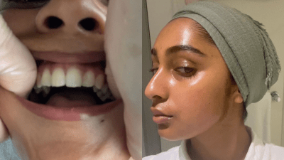 I Tried A Buccal Facial For My Jaw Pain & Let Me Tell Ya, My Mouth Being Fingered Was Worth It